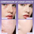 thumbnail image 4 of Evanesce Soft Matte Cream Concealer, Evanesce Soft Matte Cream Foundation, Waterproof Foundation, Full Coverage, Hydrating Long-Lasting Concealer (Ivory, One Size), 4 of 6