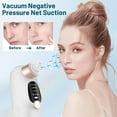 thumbnail image 6 of JUUTREN Blackhead Remover Pore Vacuum for Face, Water Cycle Facial Pimple Pore Cleanser with 3 Suction Levels, 6 Heads for Deep Cleansing & Skin Care, Electric Facial Cleansing Tool for Women & Men, 6 of 7