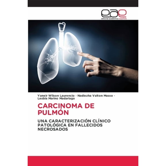 Carcinoma de Pulmón, (Paperback)