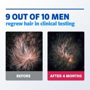 Mens Rogaine 5% Minoxidil Foam Hair Loss Treatment, 1-Month Supply