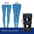 thumbnail image 4 of Adjustable O/X Type Leg Correction Band – Bowed Legs & Knock Knees Straightening Strap, Posture Corrector Beauty Leg Brace for Adults02 Adult, 4 of 5