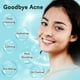 thumbnail image 5 of Kit de rutina para el cuidado de la piel facial para mujeres y adolescentes, 5 of 7