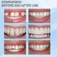 thumbnail image 3 of 30ml Moldable False Teeth White Particles Reusable Non-toxic Temporarily Fill Regain Smile, 3 of 5