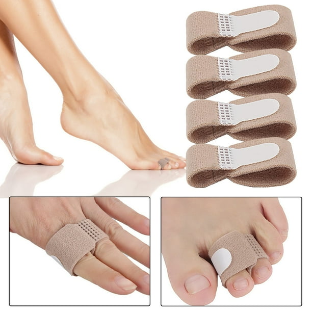 Bruised Toe Treatment