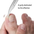 thumbnail image 3 of 2Pcs/Set Toe Nail Correction Nippers Cutters Dead Skin Dirt,Silver Nail Gel, 3 of 8