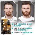 thumbnail image 4 of 1/2/3/4/5Pcs Biotin Hair Spray For Man Women 20ml Repair Damage Restore Oil Scalp Repair Serum Spray Thicken Hair Health Care New, 4 of 5