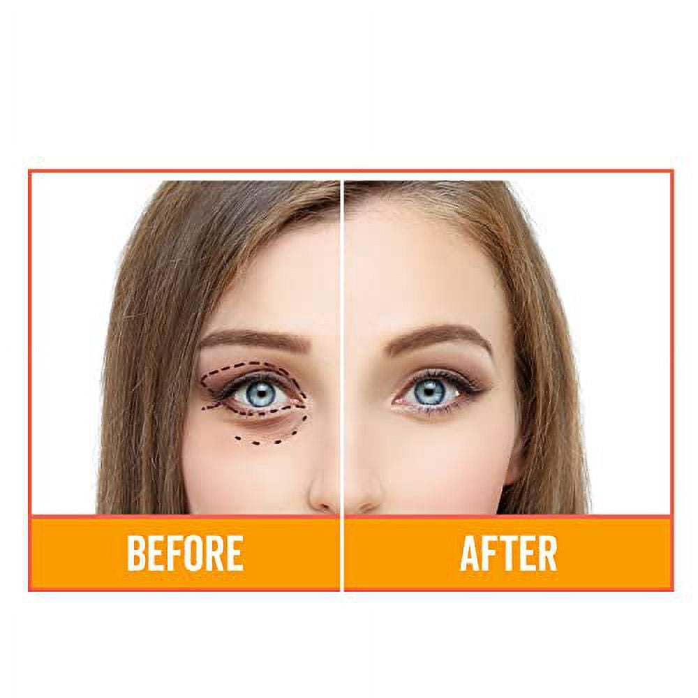 Vitasei Ellixxis Instant Eye Gel- Moisturizing Eye Lifting Cream for Dark Circles & Puffiness, Under Eye Cream for Fine Lines & Wrinkles, Anti-Aging Cream for Men & Women, Non-GMO - 0.5 Fl Oz (2 Pack)