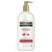 CHATTEM Gold Bond Diabetics' Dry Skin Relief Lotion 13 Oz