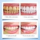 thumbnail image 5 of Pastas de dientes masticables Tabletas sabor menta natural | Nano-hidroxiapatita remineralizante sin flúor | Tarro de vidrio sin residuos | Cuidado bucal Earth Friendly Travel | 30 Recuento, 5 of 8