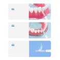 thumbnail image 4 of 50pcsInterdental Brcomhes Dental Brcomh Between Teeth For Dental Orthodontic Clean Between Teeth Cleaning Tools Soft Micro Brcomhes, 4 of 6