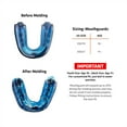 thumbnail image 5 of Shock Doctor 6100 Gel Max Sports Mouth Guard, Youth, Blue/Black, 5 of 7