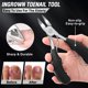 thumbnail image 3 of Cortaúñas Aucurwen para Personas Mayores con Uñas Gruesas, Set de 7 Piezas, 3 of 7