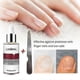 thumbnail image 2 of 1-3x Nail Repair Essence w/ Small File Protect Nail Repair Nail Toenail, 2 of 5