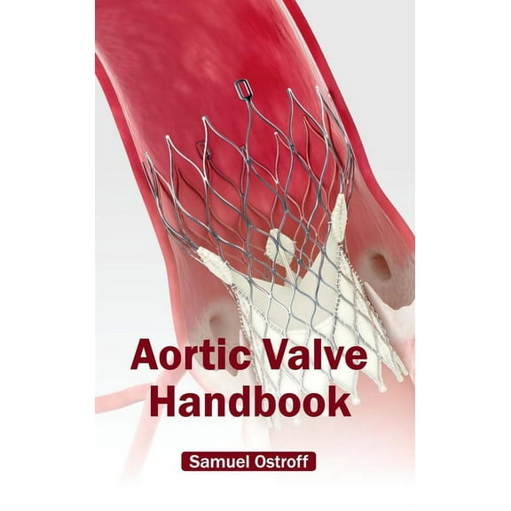 Aortic Valve Handbook, (Hardcover)