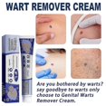 thumbnail image 2 of 3pcs Pinghouyou Wart Removing Ointment 20g, 2 of 5