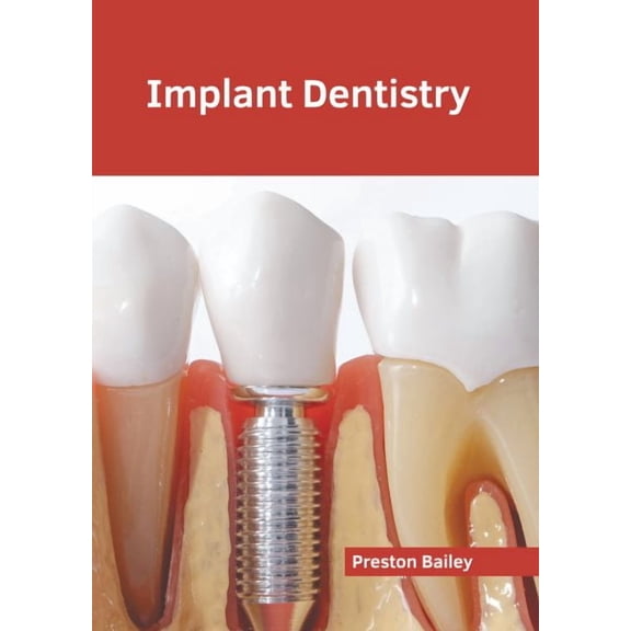 Implant Dentistry, (Hardcover)