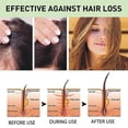 thumbnail image 3 of Aceite esencial de romero y menta para el cuidado del cabello Crecimiento del cabello Prevención de la rotura del cabello, 3 of 5
