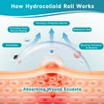 thumbnail image 6 of Hydrocolloid Roll for Wound Care, Extra Large Self-Adhesive Hydrocolloid Bandages, Cut-to-Size Patch, Ultra Absorbent & Waterproof, First Aid Kit Essential (2in*10ft), 6 of 9