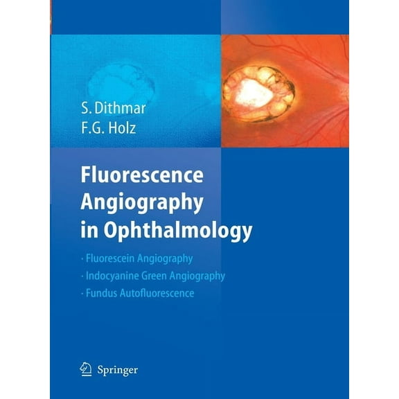 Fluorescence Angiography in Ophthalmology, (Paperback)