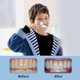thumbnail image 4 of Cepillo de dientes infantil en forma de U (con estuche), ideal para bebés y niños pequeños, ideal para una limpieza bucal completa y blanqueamiento dental., 4 of 5