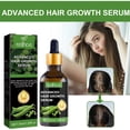 thumbnail image 3 of Suero avanzado para el crecimiento del cabello. Promueve, hidrata, fortalece el cabello y nutre el cuero cabelludo. Para hombres y mujeres. 30 ml de aceites esenciales., 3 of 5
