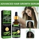 thumbnail image 3 of Suero avanzado para el crecimiento del cabello. Promueve, hidrata, fortalece el cabello y nutre el cuero cabelludo. Para hombres y mujeres. 30 ml de aceites esenciales., 3 of 5