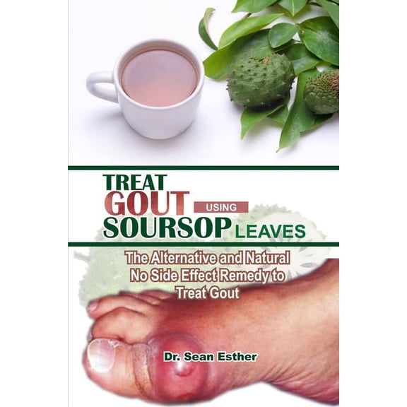 Treat Gout Using Soursop Leaves: The Alternative and Natural No Side Effect Remedy to Treat Gout, (Paperback)