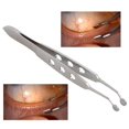 thumbnail image 2 of Pinzas de masajeador de glándulas de Meibomio, dispositivo de fisioterapia para ojos grasos, dispositivo para ojos, cirugía médica, 2# ACTIVE Biensenido a ACTIVE, 2 of 5