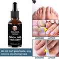 thumbnail image 5 of 3pcs Anti Fungal Nail Treatment Repair Finger Toe Care Nail Fungus Liquid, 5 of 5