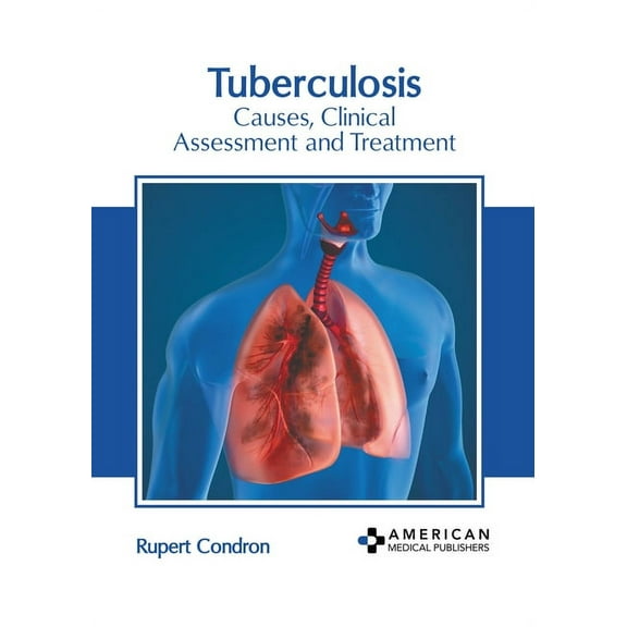 Tuberculosis: Causes, Clinical Assessment and Treatment, (Hardcover)