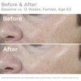 thumbnail image 2 of KAWAR Jabón de azufre del Mar Muerto con aceite de oliva para aliviar afecciones de la piel como acné, psoriasis, eczema y puntos negros para piel grasa a normal, barra de jabón vegano para hombres y, 2 of 5