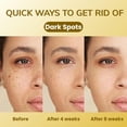 thumbnail image 4 of ABERA Kasu Anti Dark Spot Cream, 4 of 9