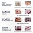 thumbnail image 4 of Fungal Nail Treatment Patches for Onychomycosis Repair, 4 of 5