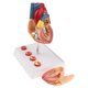 thumbnail image 5 of Modelo de trombo de tamaño natural 1: 1 Bypass Heart Teaching Aid PVC Zulema Estatua del corazón humano, 5 of 8