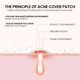 thumbnail image 5 of Love Star Shaped Acne Patch 72 Concealer Acne Patch Patch, 5 of 5
