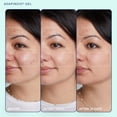 thumbnail image 3 of Gel Skinfix Acne+ Adapinoid® Resurface Clear Acne 30 ml, 3 of 8