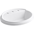 thumbnail image 2 of Kohler K-2991-1 Tresham 20" Drop In Bathroom Sink - Grey, 2 of 2