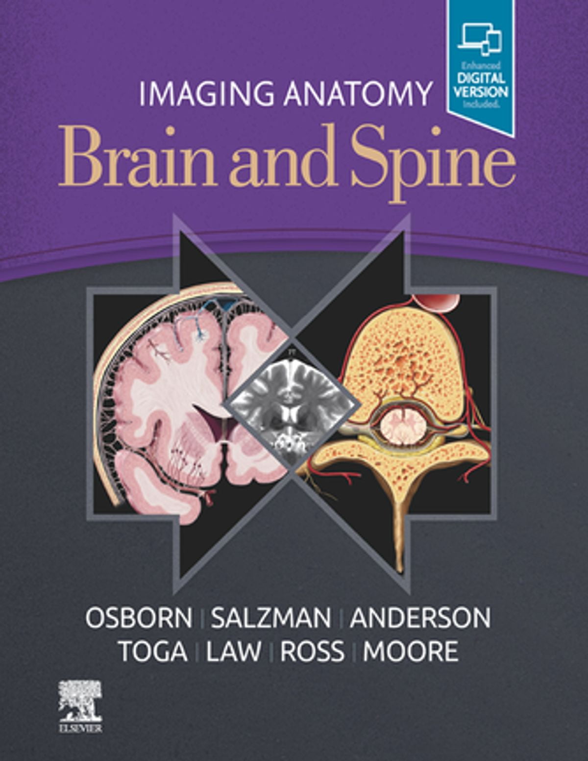 Imaging Anatomy Brain and Spine, E-Book - eBook - Walmart.com - Walmart.com