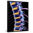 thumbnail image 1 of Spine And Spinal Nerves,computer Artwork, Framed Art Print Wall Art by PASIEKA Sold by Art.Com, 1 of 5