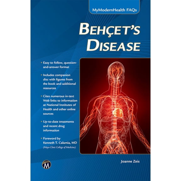 Mymodernhealth FAQs Behcet's Disease, (Paperback)