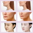 thumbnail image 4 of Silicone Patches Face Tape 1.6 x 59inch, For Burn, Scars, Surgical Scars, C-Section, Overnight Beauty Tape, Hydrated Skin, Cut To Fit, Reusable, 4 of 5