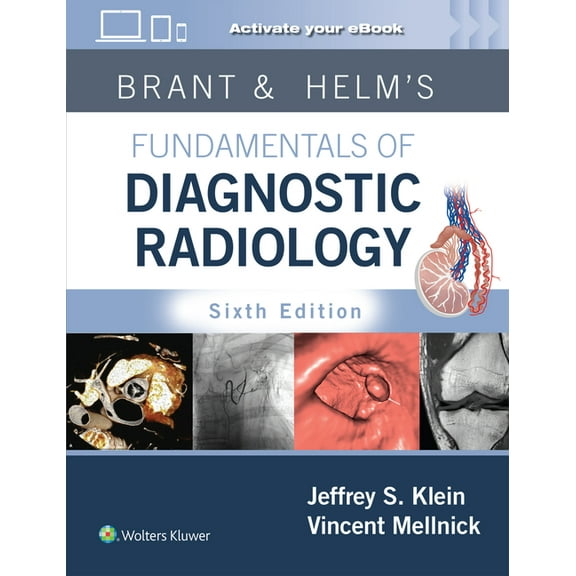 Brant & Helms' Fundamentals of Diagnostic Radiology: Print   eBook with Multimedia, (Hardcover)