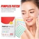 thumbnail image 2 of Limited time discount!Acne Patch For Skin Cleaning, Acne Warts, Skin Labels, Wart Cleaning, Closing Mouth, Gentle Fading, Acne Balance, Skin Acne Patches, 2 of 9