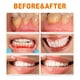 thumbnail image 4 of Fiudx Ampolla Blanqueadora Dental, Potente Gel para Eliminar El Sarro, Fórmula Reparadora para Dientes Sensibles, Pasta Dental para El Control de Placa, Solución para El Cuidado Bucal, Uso En Adultos, 4 of 6