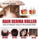 thumbnail image 4 of Natural Hair Beard Growth Derma Micro Dermaroller Hair Regrowth Anti Hair Loss Men Hair, 4 of 5