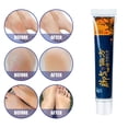 thumbnail image 4 of Crema reparadora para pies de atleta HUOGUO Beriberi Odor 15 g, 4 of 5