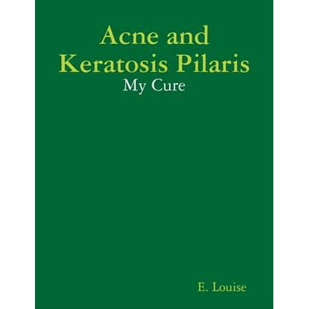 Acne and Keratosis Pilaris - My Cure - eBook
