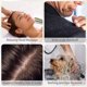 thumbnail image 5 of Cepillo Para Champú Para El Cabello, Depurador De Cuero Cabelludo De Silicona Suave, Masajeador Portátil Ergonómico Para El Cuero Cabelludo, Herramienta Para El Cuidado Del Cabello Muyoka Hogar, 5 of 7