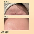 thumbnail image 5 of Cosrx Advanced Snail 96 Mucin Power Essence, 3.38 Ounce 2018, 5 of 8