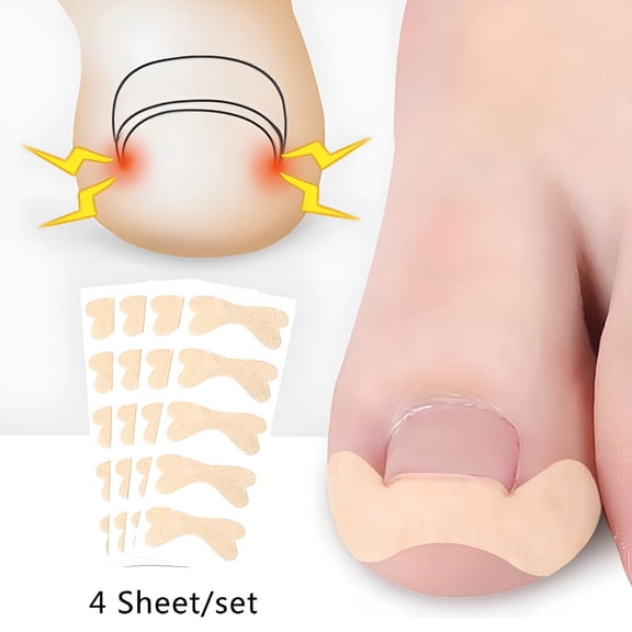 RAGUPEL 20Pcs Toenail Corrector Ingrown Toe Foot Nail Correction Patch Nail Sticker Nail Repair Patches